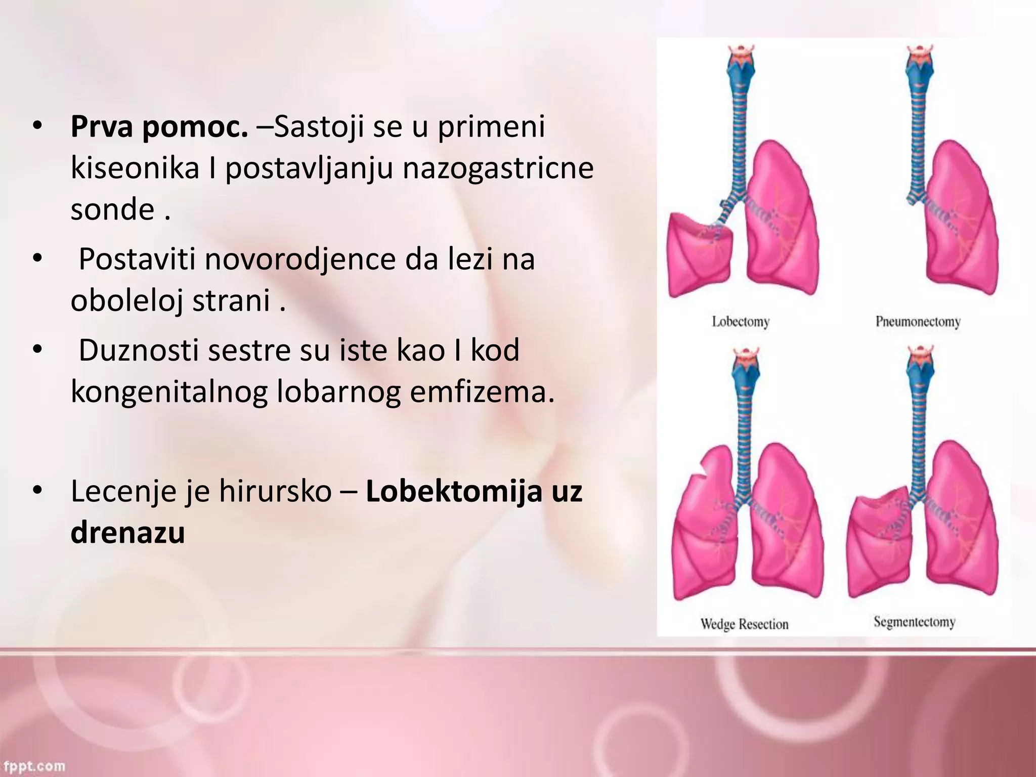 Nazogastricna sonda | PPT