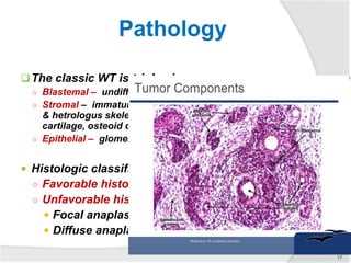The classic WT is triphasic
○ Blastemal – undifferentiated cells
○ Stromal – immature spindle cells
& hetrologus skeletal muscle,
cartilage, osteoid or fat
○ Epithelial – glomerular & tubules
 Histologic classification
○ Favorable histology – 90%
○ Unfavorable histology –10%
 Focal anaplasia
 Diffuse anaplasia
Pathology
17
 