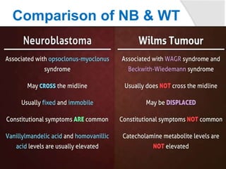 Comparison of NB & WT
27
 