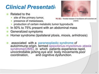 Clinical Presentation
 Related to the
 site of the primary tumor,
 presence of metastases,
 production of certain metabolic tumor byproducts
 In 50% to 75% present with an abdominal mass
 Generalized symptoms
 Horner syndrome (Ipsilateral ptosis, miosis, anhidrosis)
 associated with a paraneoplastic syndrome of
autoimmune origin, termed opsoclonus-myoclonus–ataxia
syndrome(OMS), in which patients experience rapid,
uncontrollable jerking eye and body movements,poor
coordination, and cognitive dysfunction.
5
 