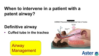 When to intervene in a patient with a
patent airway?
Definitive airway
• Cuffed tube in the trachea
Airway
Management
 