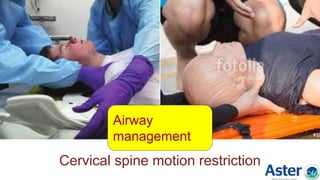 Cervical spine motion restriction
Airway
management
 