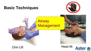 Basic Techniques
Chin Lift Head tilt
Airway
Management
 