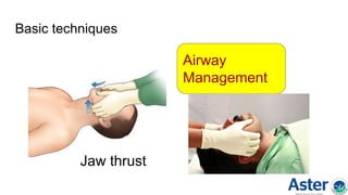 Basic techniques
Airway
Management
Jaw thrust
 