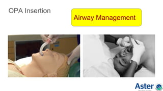 OPA Insertion
Airway Management
 