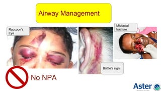 No NPA
Airway Management
Raccoon’s
Eye
Battle's sign
Midfacial
fracture
 
