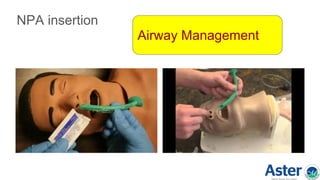 NPA insertion
Airway Management
 