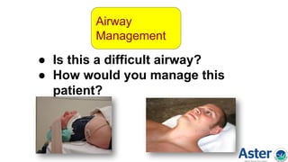 Airway
Management
● Is this a difficult airway?
● How would you manage this
patient?
 
