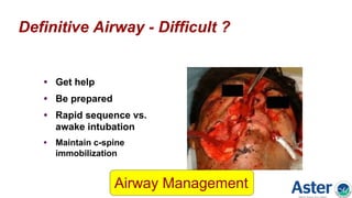 Definitive Airway - Difficult ?
• Get help
• Be prepared
• Rapid sequence vs.
awake intubation
• Maintain c-spine
immobilization
Airway Management
 