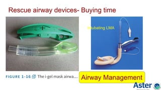 Rescue airway devices- Buying time
Intubating LMA
Airway Management
 