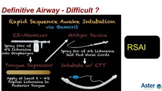 Definitive Airway - Difficult ?
RSAI
 