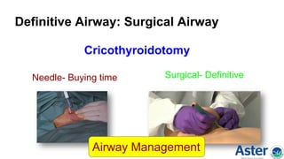 Definitive Airway: Surgical Airway
Cricothyroidotomy
Needle- Buying time Surgical- Definitive
Airway Management
 