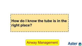 How do I know the tube is in the
right place?
Airway Management
 