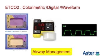ETCO2 : Colorimetric /Digital /Waveform
Airway Management
 