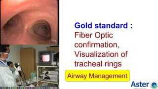 Gold standard :
Fiber Optic
confirmation,
Visualization of
tracheal rings
Airway Management
 