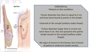 STADIUM IIa:
Patients in this condition:
•Tumor diameter less than or equal to 2 cm
and have been found at points in the lymph.
•channels in the armpit (axillary nodes limph)
•Tumor diameter larger than 2 cm but not
more than 5 cm. Has not spread to the points
lymph vessels in the armpit (axillary nodes
limph).
•No signs of tumors in the breast, but is found
at points in underarm lymph vessels.
 