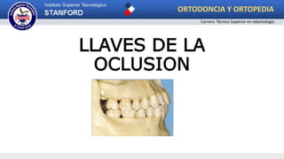 LLAVES DE LA
OCLUSION
ORTODONCIA Y ORTOPEDIA
Carrera: Técnico Superior en odontología
 
