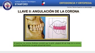 LLAVE II: ANGULACIÓN DE LA CORONA
Al examinar las coronas Andrews constató que la parte gingival del eje largo de la corona,
se localiza distalmente a la parte oclusal del mismo.
ORTODONCIA Y ORTOPEDIA
Carrera: Técnico Superior en odontología
 