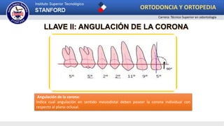 LLAVE II: ANGULACIÓN DE LA CORONA
Angulación de la corona:
Indica cual angulación en sentido mesiodistal deben poseer la corona individual con
respecto al plano oclusal.
ORTODONCIA Y ORTOPEDIA
Carrera: Técnico Superior en odontología
 
