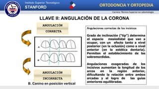 LLAVE II: ANGULACIÓN DE LA CORONA
ANGULACIÓN
INCORRECTA
Angulaciones correctas de los incisivos
Grado de inclinación (“tip”) determina
el espacio mesiodistal que van a
ocupar, con un efecto tanto a nivel
posterior (en la oclusión) como a nivel
anterior (en la estética dentaria).
Permiten el establecimiento de las
sobremordidas.
Angulaciones exageradas de los
incisivos aumentan la longitud de los
arcos en la región anterior,
dificultando la relación entre ambos
arcadas y el logro de las guías
anteriores equilibradas.
ANGULACIÓN
CORRECTA
B. Canino en posición vertical
ORTODONCIA Y ORTOPEDIA
Carrera: Técnico Superior en odontología
 