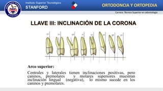 Arco superior:
Centrales y laterales tienen inclinaciones positivas, pero
caninos, premolares y molares superiores muestran
inclinación lingual (negativa), lo mismo sucede en los
caninos y premolares.
LLAVE III: INCLINACIÓN DE LA CORONA
ORTODONCIA Y ORTOPEDIA
Carrera: Técnico Superior en odontología
 