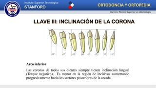 Arco inferior
Las coronas de todos sus dientes siempre tienen inclinación lingual
(Torque negativo). Es menor en la región de incisivos aumentando
progresivamente hacia los sectores posteriores de la arcada.
LLAVE III: INCLINACIÓN DE LA CORONA
ORTODONCIA Y ORTOPEDIA
Carrera: Técnico Superior en odontología
 