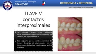 LLAVE V
contactos
interproximales
 Los dientes deben estar ubicados
perfectamente relacionados con sus puntos de
contacto, sin espacios entre sí.
 Esto requiere que no existan anomalías de
formas dentarias ni discrepancias en el
diámetro mesiodistal de los dientes de ambos
maxilares
ORTODONCIA Y ORTOPEDIA
Carrera: Técnico Superior en odontología
 