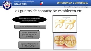 Los puntos de contacto se establecen en:
Áreas de mayor convexidad en
las caras proximales:
Surco interproximal (oclusal)
Espacio interproximal
(cervical al punto de
contacto )
Espacios interproximales
(vestibular y lingual)
ORTODONCIA Y ORTOPEDIA
Carrera: Técnico Superior en odontología
 