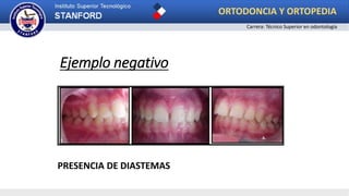 Ejemplo negativo
PRESENCIA DE DIASTEMAS
ORTODONCIA Y ORTOPEDIA
Carrera: Técnico Superior en odontología
 