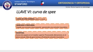 LLAVE VI: curva de spee
MARCADA O PROFUNDA:
Impide una correcta intercuspación generando una oclusión traumática
INVERTIDA:
Exceso de espacio en el maxilar superior Provocando alteraciones en el
plano oclusal, falta de guía incisiva y finalmente oclusión traumática
CURVA DE SPEE NORMAL: plana o suave
ORTODONCIA Y ORTOPEDIA
Carrera: Técnico Superior en odontología
 