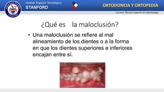 ¿Qué es la maloclusión?
• Una maloclusión se refiere al mal
alineamiento de los dientes o a la forma
en que los dientes superiores e inferiores
encajan entre sí.
ORTODONCIA Y ORTOPEDIA
Carrera: Técnico Superior en odontología
 