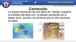 Corrección
La simple colocación de una placa de Hawley, impedirá
el contacto del dedo con el paladar perdiendo así el
placer de la succión, de tal forma que el niño eliminara
el habito.
ORTODONCIA Y ORTOPEDIA
Carrera: Técnico Superior en odontología
 