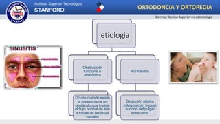 etiologia
Obstrucción
funcional o
anatómica
Ocurre cuando existe
la presencia de un
obstáculo que impide
el flujo normal de aire
a través de las fosas
nasales
Por habitos
Deglución atípica
,interposición lingual,
succión del pulgar
entre otros
ORTODONCIA Y ORTOPEDIA
Carrera: Técnico Superior en odontología
 