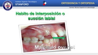 ORTODONCIA Y ORTOPEDIA
Carrera: Técnico Superior en odontología
 