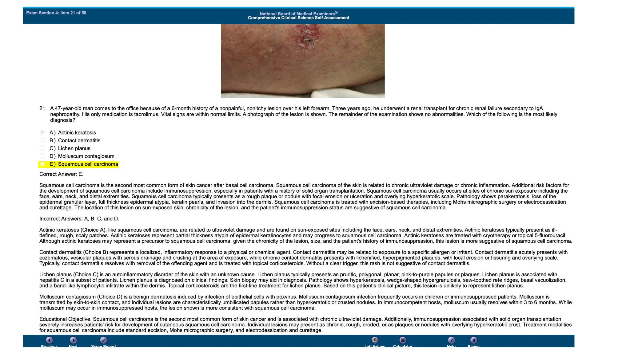 NBME 14 - ANSWERS.pdf for usmle step 2 CK