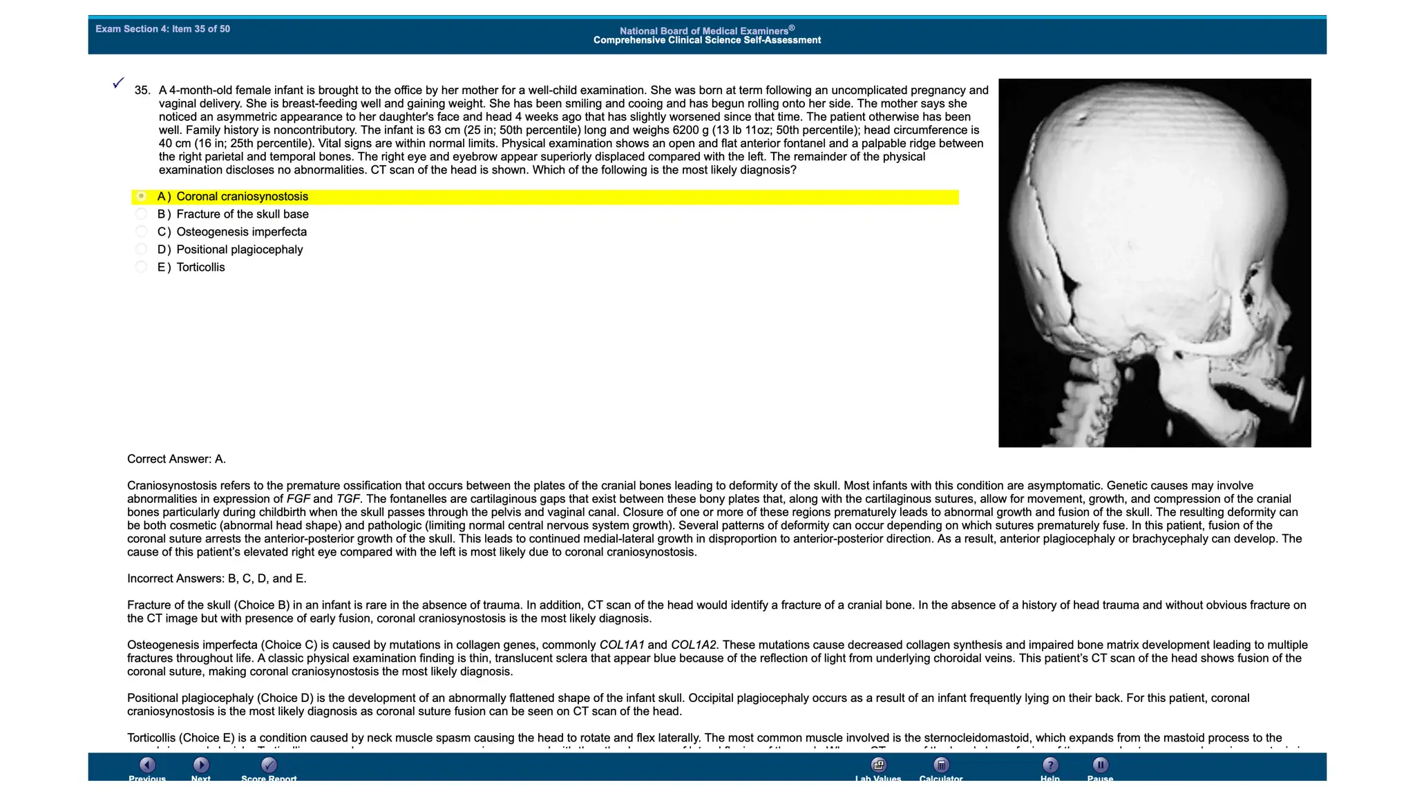 NBME 14 - ANSWERS.pdf for usmle step 2 CK