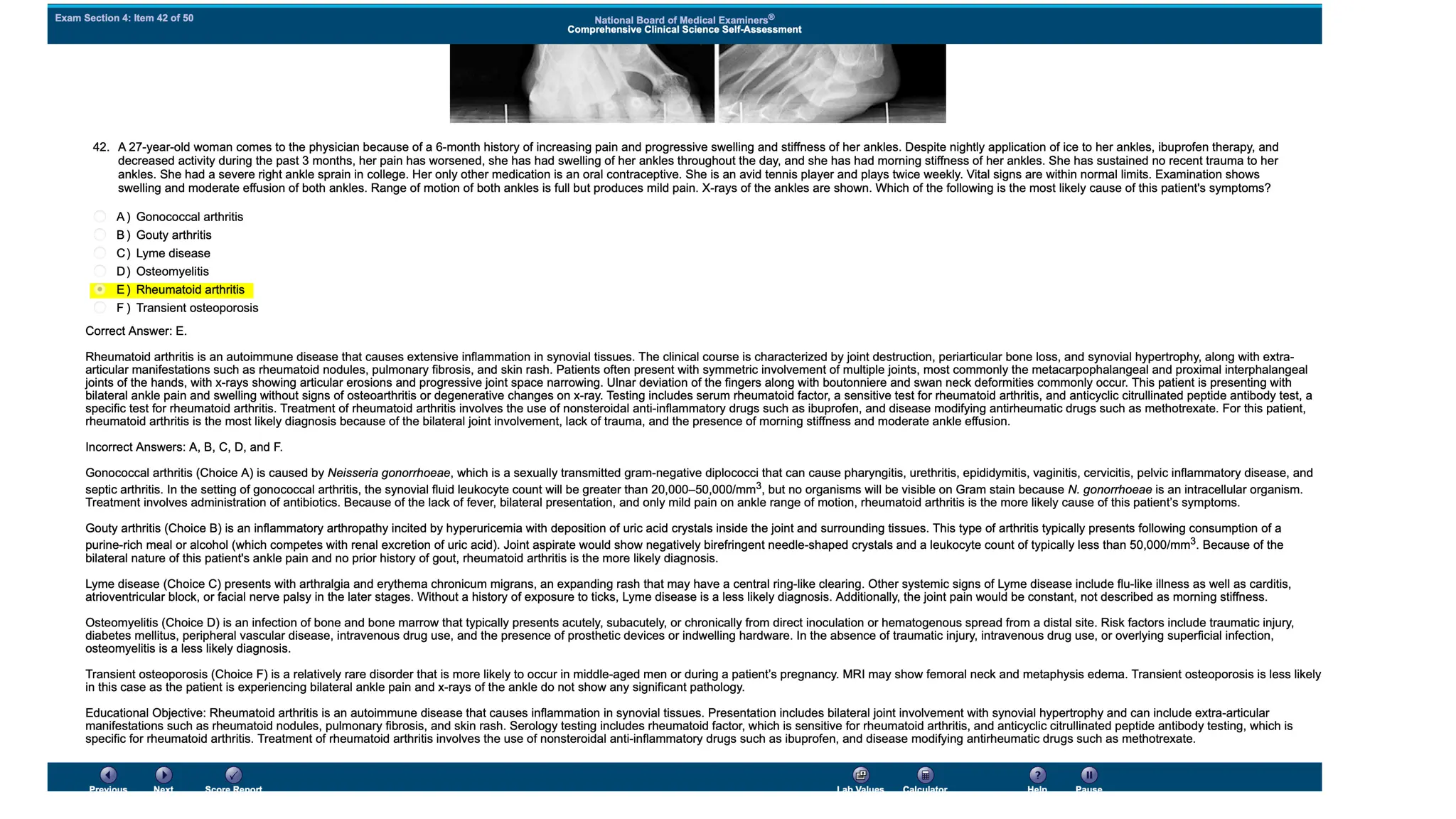 NBME 14 - ANSWERS.pdf for usmle step 2 CK