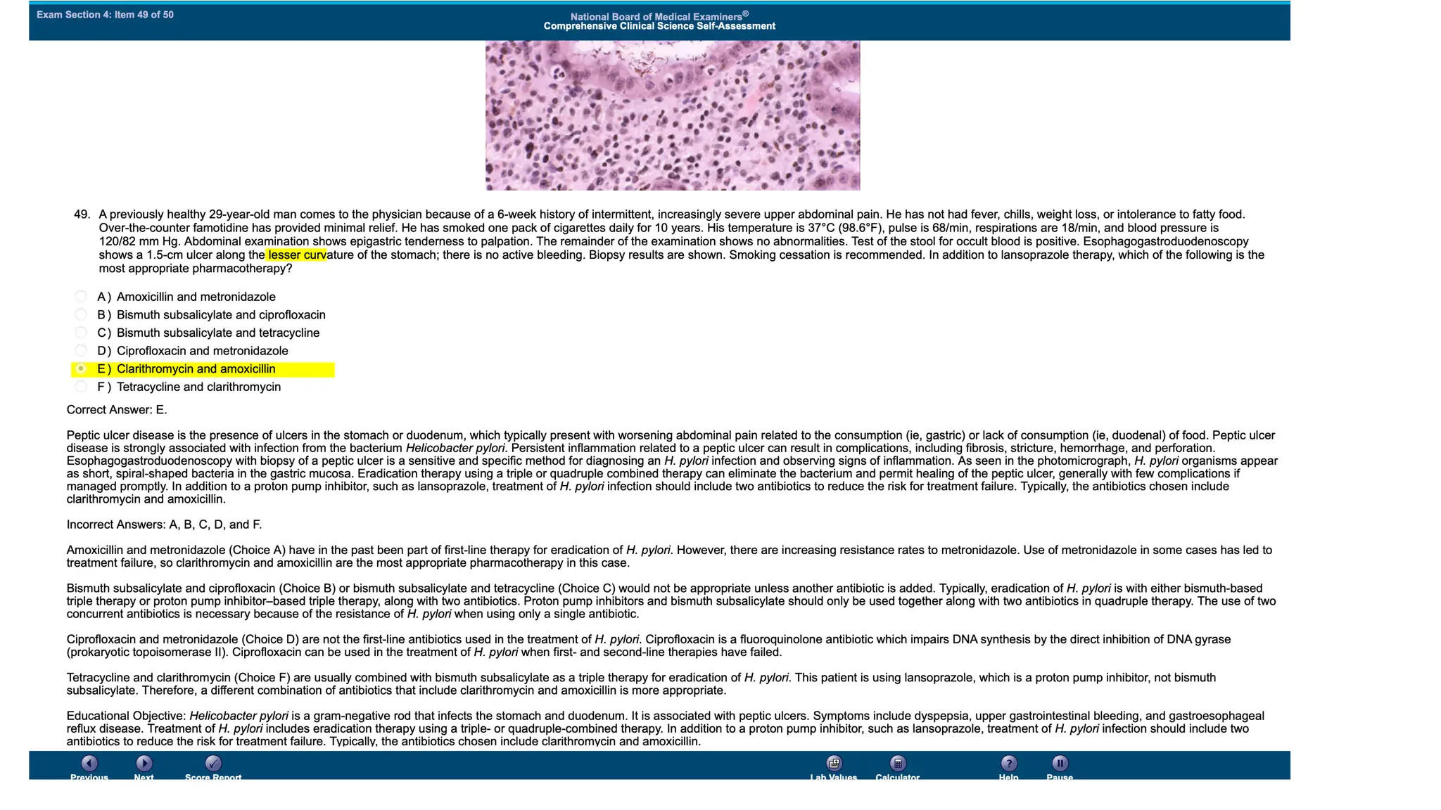 NBME 14 - ANSWERS.pdf for usmle step 2 CK