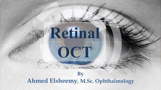 By
Ahmed Elsheemy, M.Sc. Ophthalmology
Retinal
OCT
 