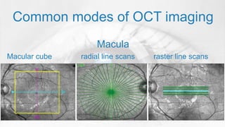 Oct Circular Raster OCT basics | PPTX