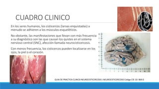 CUADRO CLINICO
En los seres humanos, los cisticercos (larvas enquistadas) a
menudo se adhieren a los músculos esqueléticos.
No obstante, las manifestaciones que llevan con más frecuencia
a su diagnóstico son las que causan los quistes en el sistema
nervioso central (SNC), afección llamada neurocisticercosis.
Con menos frecuencia, los cisticercos pueden localizarse en los
ojos, la piel o el corazón.
GUIA DE PRACTICA CLINICA NEUROCISTICERCOSIS I.NEUROCISTICERCOSIS Código CIE-10: B69.0
 