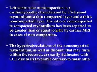 Non coronary cardiac CT | PPT