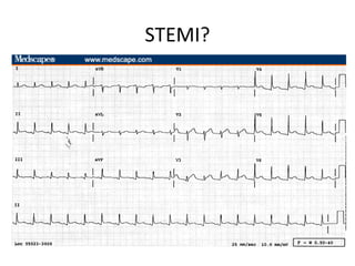 Chest Pain Evaluation in Corrections | PPT