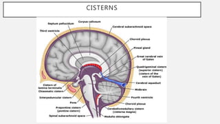 Ncct and cect brain and orbit | PPTX