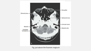 Ncct and cect brain and orbit | PPTX