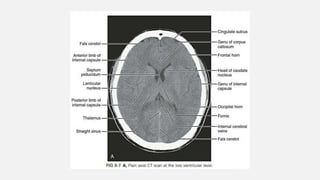 Ncct and cect brain and orbit | PPTX