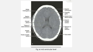 Ncct and cect brain and orbit | PPTX