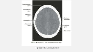 Ncct and cect brain and orbit | PPTX