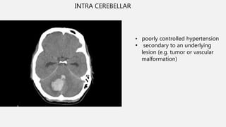 Ncct and cect brain and orbit | PPTX