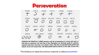 The tendency to repeat the previous response is called perseveration
Perseveration
 